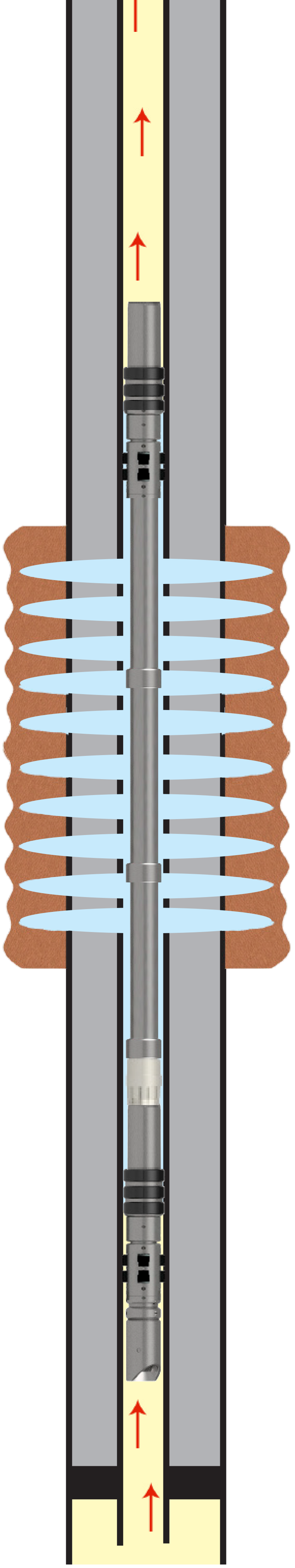 Retrievable Straddle for Zone Isolation